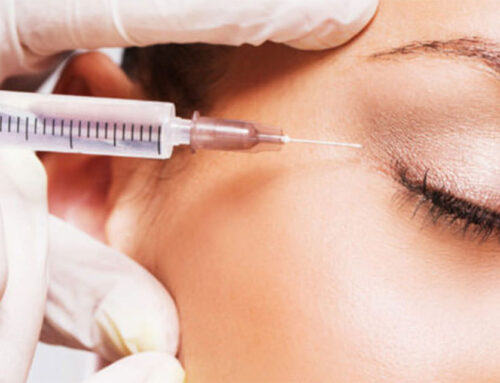 Botox: conheça a maneira infalível de eliminar as rugas da testa!